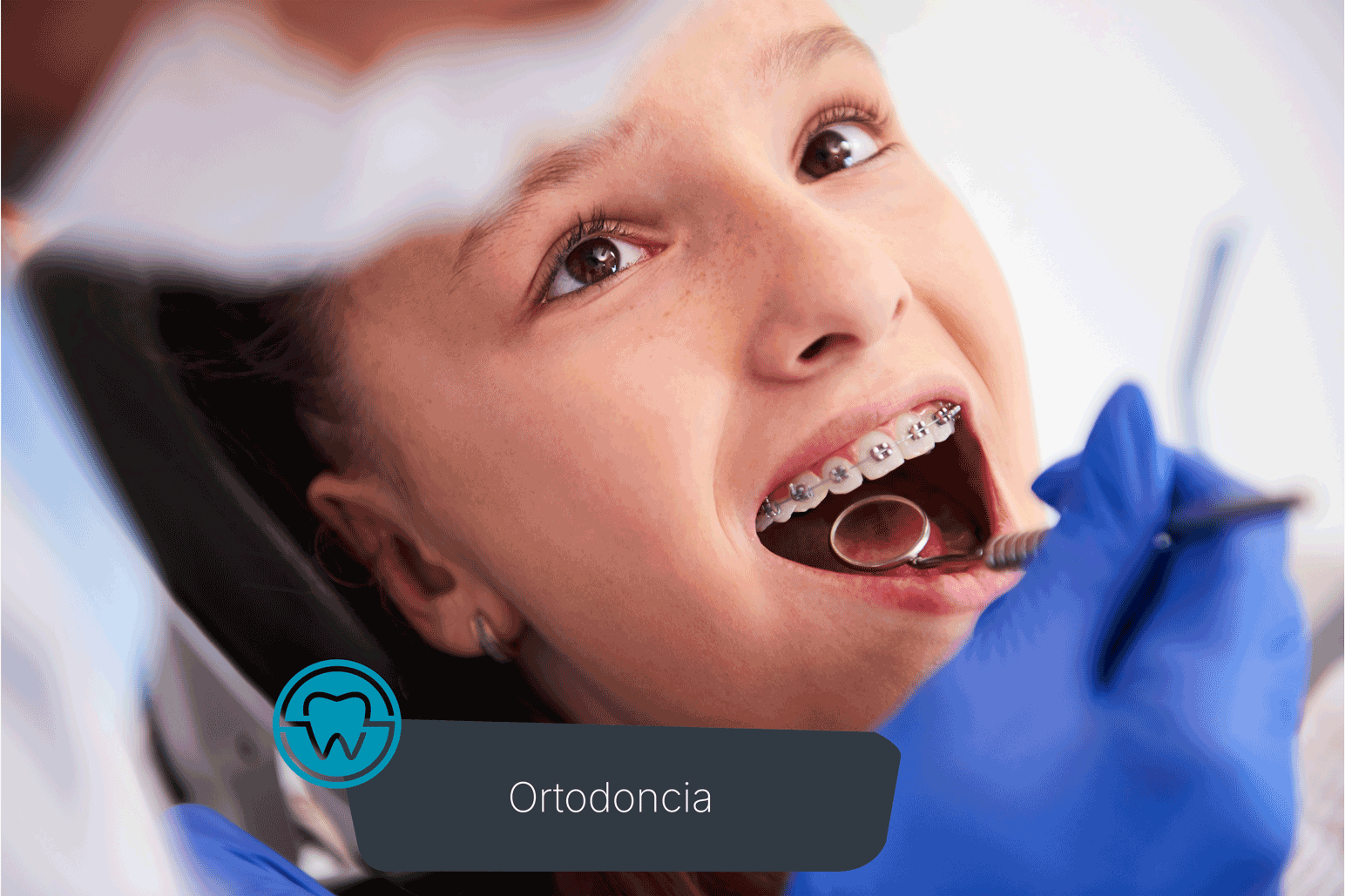 Estética Dental